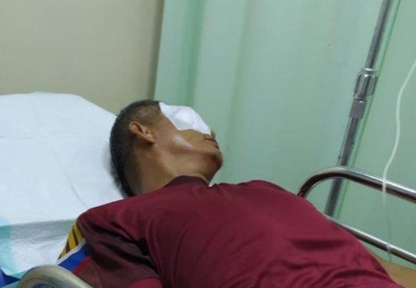Ketapel Mata Guru Hingga Buta, Orang Tua Siswa Divonis 13 Tahun