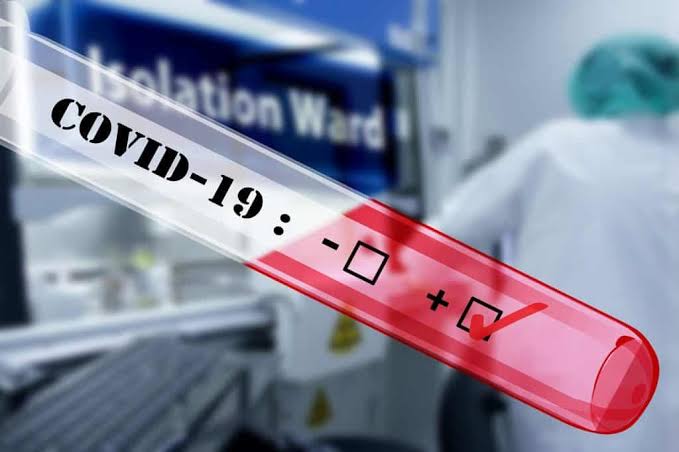 Waduh! Hasil Swab Massal, 63 Pegawai Dinas PUPR PKPP Riau Positif Covid-19