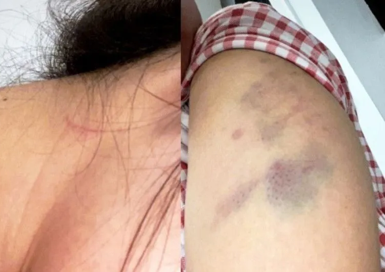 Tak Restui Hubungan Asmara Adiknya, Polwan di Pekanbaru Aniaya Wanita