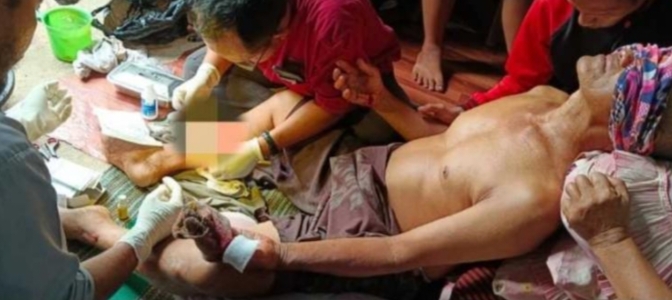Mau Langsir Hasil Panen, Petani Sawit Diserang Orangutan