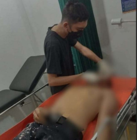 Usai Pesan Minuman Ringan, Mr X Tumbang di Warung Remang-remang