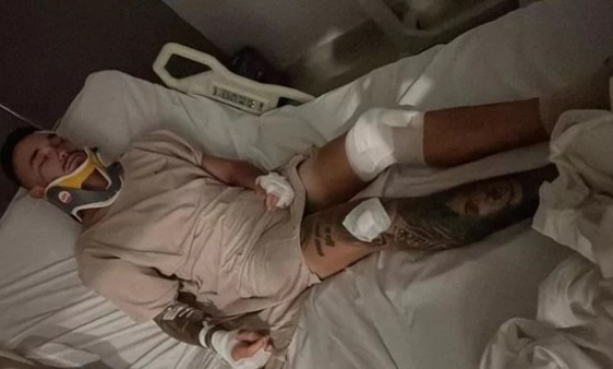 Niat Liburan, Bule di Bali Malah Dirampok dan Dipukuli