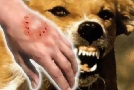 Warga Inhil Meninggal Pasca Digigit Anjing Rabies, Bupati Wardan Minta Warga Waspada dan Aktif Melapor