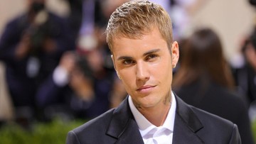 Justin Bieber Derita Kelumpuhan Wajah