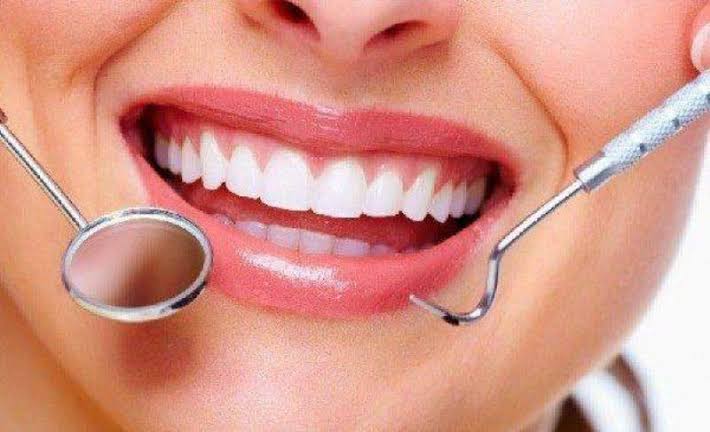 7 Cara Mencegah Munculnya Karang Gigi
